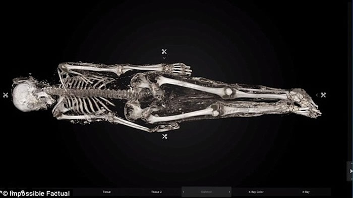 美国纽约皇后区工地挖出19世纪铁棺女尸 死因是天花