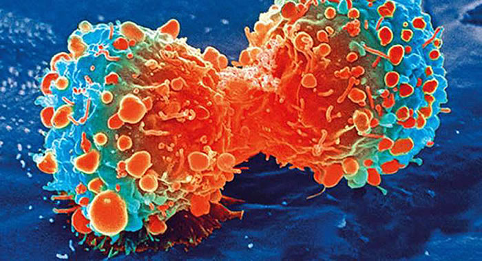美国约翰霍普金斯癌症中心成功试验晚期癌症药物——纳武单抗