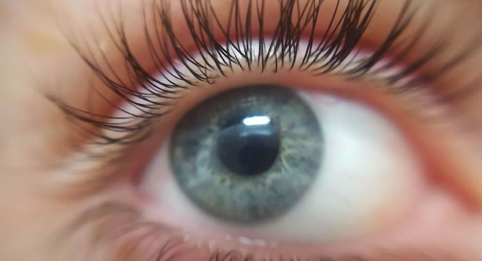 英国专家介绍确定眼睛缺少维生素B12的办法