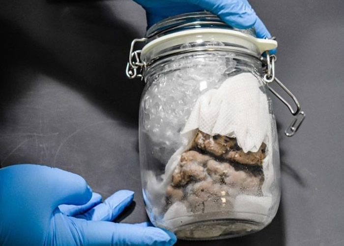 美国密歇根州边境一辆入境的加拿大邮政车发现载有人脑的密封玻璃瓶