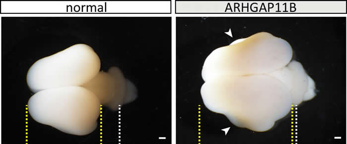 首次确认人类特有的“聪明基因”ARHGAP11B 进化过程中与其它灵长类区分的重要机制