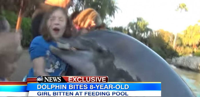 开心逛海洋世界公园，8岁女童竟惨遭海豚狠咬手！（图／翻摄自ABC News）