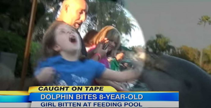 开心逛海洋世界公园，8岁女童竟惨遭海豚狠咬手！（图／翻摄自ABC News）